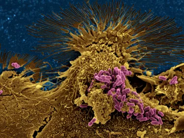 Bactéries Escherichia coli ©  Institut Pasteur/Chantal Le Bouguénec