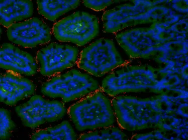 Cellules de l'intestin grêle murin et bactéries © Institut Pasteur/Gérard Eberl