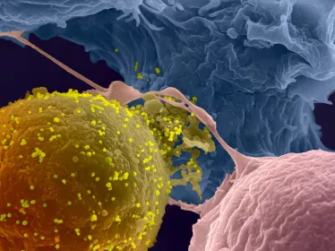 La transmission du VIH-1 de cellule à cellule © Institut Pasteur