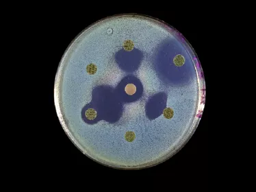Klebsiella pneumoniae copyright Institut Pasteur