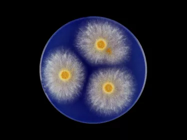 aspergillusflavus copyright Institut Pasteur