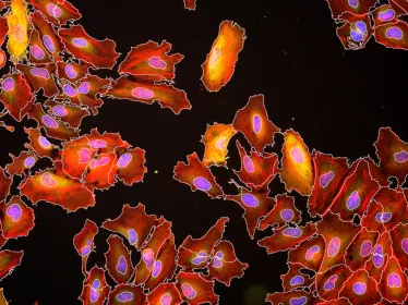 Listeria monocytogenes copyright Institut Pasteur