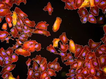 Immunofluorescence et analyse par segmentation de cellules HeLa infectées par la bactérie Listeria monocytogenes © Institut Pasteur