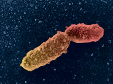  Bordetella pertussis copyright Institut Pasteur