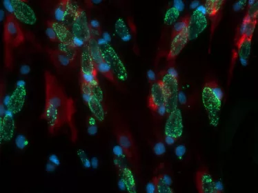 Cellules humaines infectées par Chlamydia trachomatis © Institut Pasteur/Sébastien Triboulet et Agathe Subtil