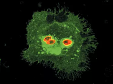 Cellules dendritiques de souris infectées par Leishmania mexicana amazonensis 