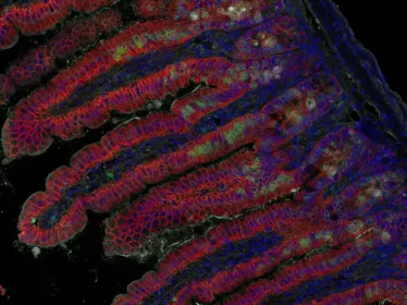  Imagerie en fluorescence de villosités intestinales après infection par Listeria monocytogenes ©  Institut Pasteur