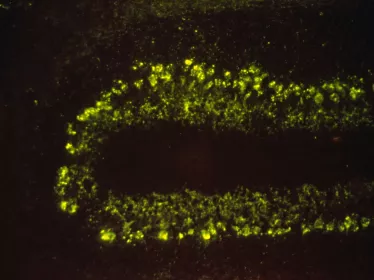 Cervelet de rat infecté par le virus de la rage - Institut Pasteur