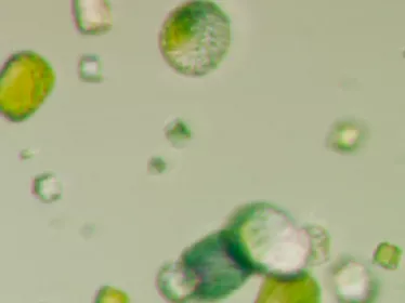 Cristaux de protéines produits à la plateforme de cristallogénèse et diffraction des rayons X de l'Institut Pasteur de Paris. © Institut Pasteur