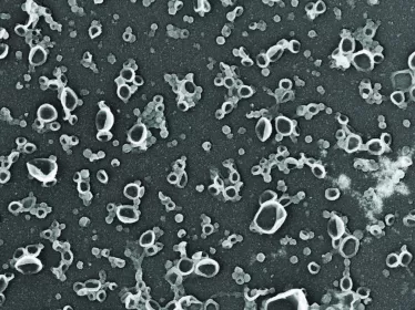 sacs poubelles cellulaires © Thomas Wollert