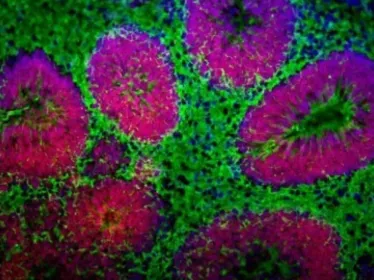 organoides-cerebraux-microscope © SupBiotech/Institut Pasteur