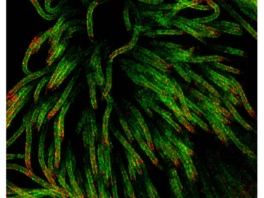 Récepteur cellulaire TMPRSS2 (en rouge) à la surface de cellules respiratoires ciliées (en vert) – Image obtenue par microscopie optique à haute résolution 