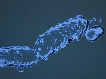 Bordetella pertussis ou bacille de Bordet Gengou. Coccobacille à Gram négatif, aérobie strict, encapsulé au sortir de l'organisme, immobile. Bactérie fragile et difficile à cultiver. Agent de la coqueluche, maladie respiratoire aigüe pouvant être mortelle