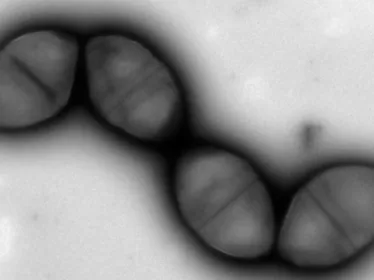 Chainette de Streptococcus pneumoniae en microscopie électronique à transmission.