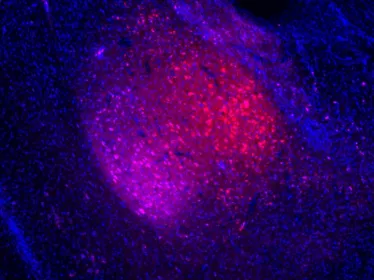 Dépression : un dysfonctionnement de certains neurones de l’amygdale serait à l’origine de la perception négative de l’environnement 