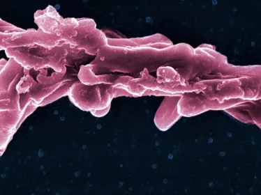 Mycobacterium