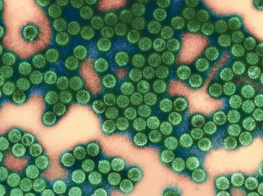 5 raisons de suivre le MOOC "Viruses and Human Cancer"