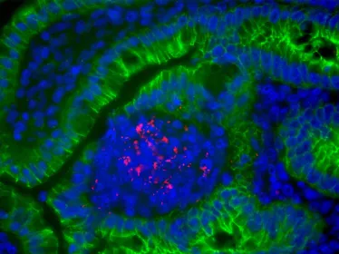 Tissu intestinal de gerbille infecté par Listeria monocytogenes. Listeria monocytogenes est marquée en rouge, la E-cadhérine des cellules épithéliales en vert, et les noyaux cellulaires en bleu. Institut Pasteur/Biologie des Infections - Marc Lecuit