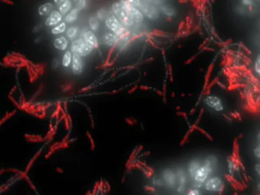 Photo de microscopie - Bactérie symbiotique (rouge) attachée à l'intestin (en blanc)