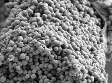 Staphylocccus aureus - Microscopie