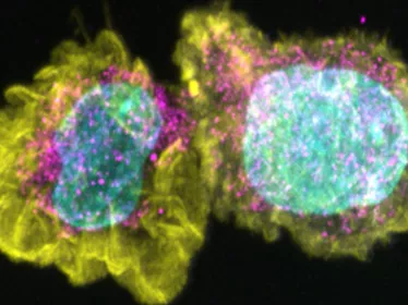 Virus de la rougeole perturbant le réseau mitochondrial et le métabolisme cellulaire