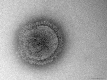 Photomicrographie du virus de la grippe A. 