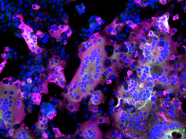 Microscopie à fluorescence de cellules infectées par le virus SARS-CoV-2 