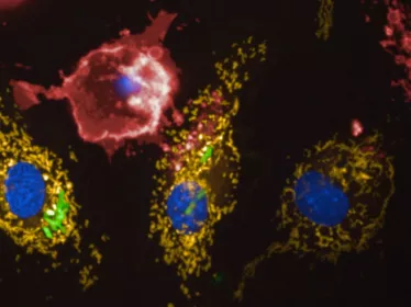 Legionella pneumophila (en vert) détourne l'ATPase mitochondriale pour maintenir le potentiel membranaire mitochondrial mesuré avec le colorant TMRM (orange) des macrophages primaires humains infectés, ce qui retarde l'acquisition de marqueurs de mort cel