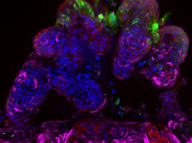 Coupe transversale d'un Ileum-organoid-on-chip humain infecté par le SARS-CoV-2 pendant 48 heures. 