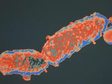 Image de microscopie de Bordetella pertussis