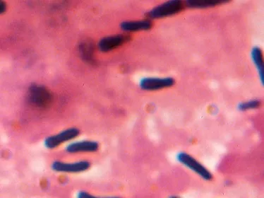 Corynebacterium diphteriae (ou bacille de Klebs et Loeffler)