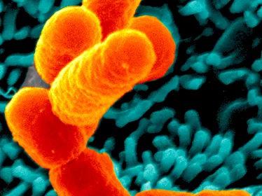 Bactéries Escherichia coli O104:H4 (souche 55989) en interaction avec des cellules de l'épithélium intestinal humain (lignée T84). 