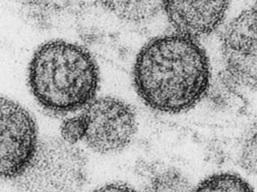 Hantavirus