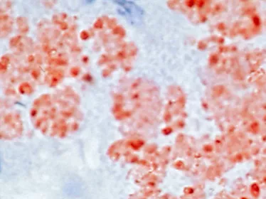 Foie de souris expérimentalement infecté par le bacille de la peste Yersinia pestis - Institut Pasteur
