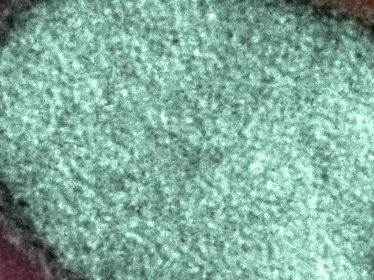 Virus de la rage en microscopie électronique. Image colorisée - Institut Pasteur