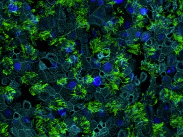 Tissu respiratoire humain, avec les cellules ciliées marquées en vert (anticorps anti-TMPRSS2), noyaux en bleu foncé, membranes cellulaires en bleu clair. 