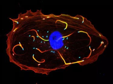 Cellule infectée par Listeria monocytogenes
