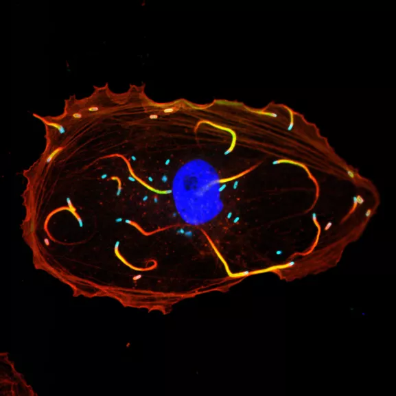 Cellule infectée par Listeria monocytogenes