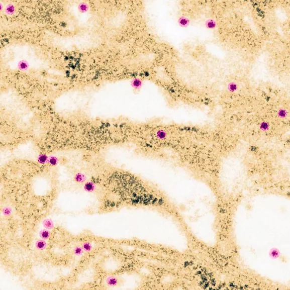 Photographie de microscopie 