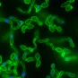 Fiches maladies - Candidoses - Institut Pasteur