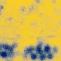 Fiches maladies - Fièvre jaune - Institut Pasteur