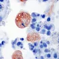 Entamoeba histolytica - Institut Pasteur