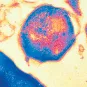 Fiches maladies - Lèpre - Institut Pasteur