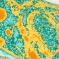 Fiches maladies - Paludisme - Institut Pasteur