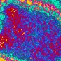 Fiches maladies - Rage - Institut Pasteur