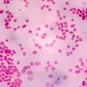 Fiches maladies - Sepsis Septicémie - Institut Pasteur