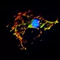 Listeria - Institut Pasteur