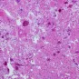 sepsis - Institut Pasteur