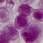 Chlamydia trachomatis - Institut Pasteur