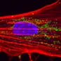 New therapies for brain disorders - Institut Pasteur